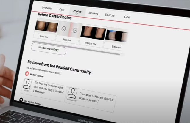 Emsculpt neo featured on The RealSelf